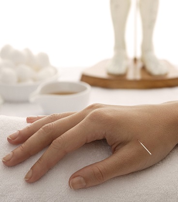 דיקור סיני לטיפול בחרדה