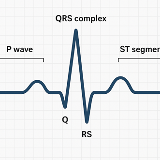 תרשים EKG